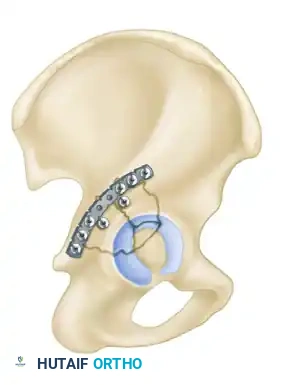 Hutaifortho's Orthopaedic Diagram