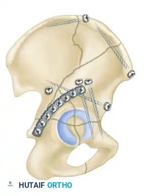 Hutaifortho's Orthopaedic Diagram