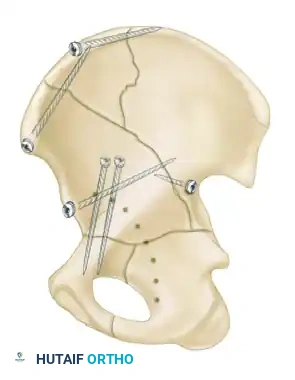 Hutaifortho's Orthopaedic Diagram