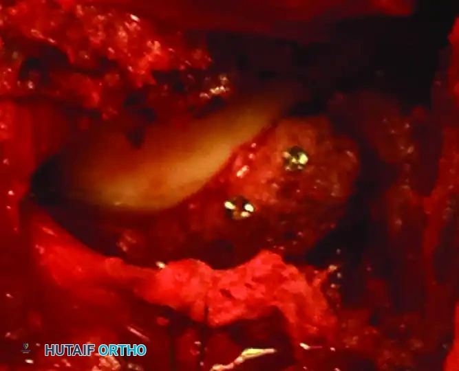 Hutaifortho's Orthopaedic Diagram