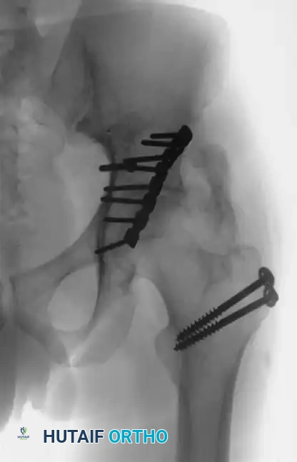 Hutaifortho's Orthopaedic Diagram