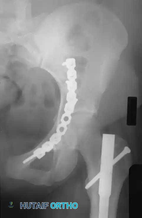 Hutaifortho's Orthopaedic Diagram