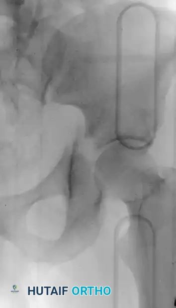 Hutaifortho's Orthopaedic Diagram