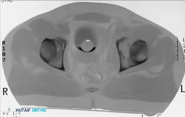 Hutaifortho's Orthopaedic Diagram