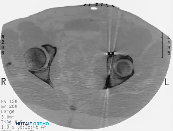 Hutaifortho's Orthopaedic Diagram