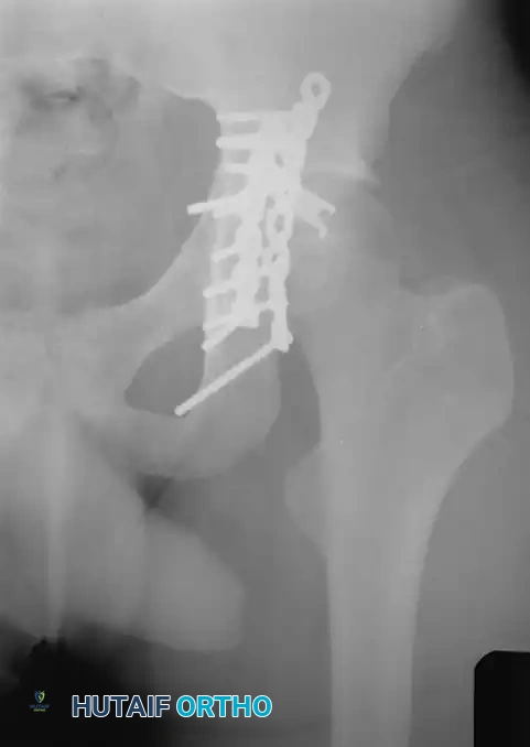 Hutaifortho's Orthopaedic Diagram