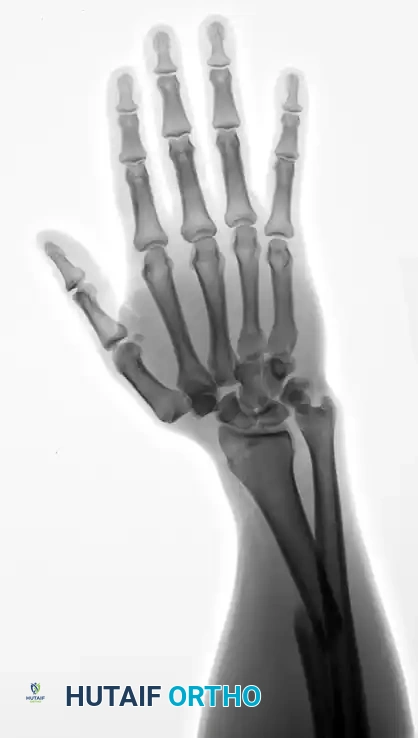 CLASSIFICATION Surgical Diagram