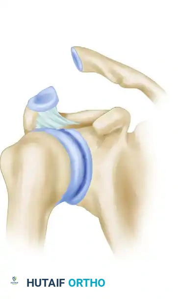 CLINICAL FINDINGS Surgical Diagram