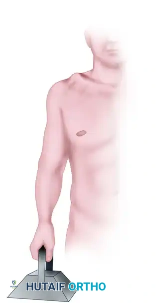 CLINICAL FINDINGS Surgical Diagram