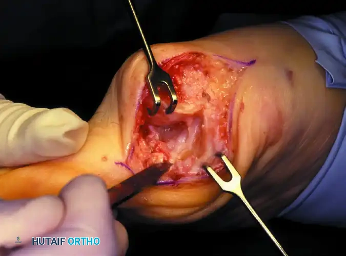 Hutaifortho's Orthopaedic Diagram