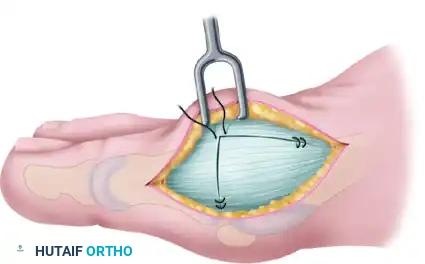 Hutaifortho's Orthopaedic Diagram