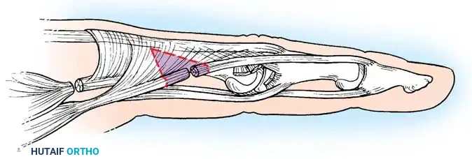 Hutaifortho's Orthopaedic Diagram