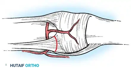 Complications of Hand Fractures: Advanced Surgical Management
