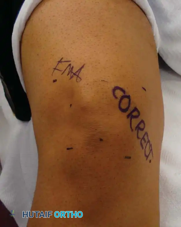 Complications in Arthroscopic Surgery: Prevention, Recognition, and Management