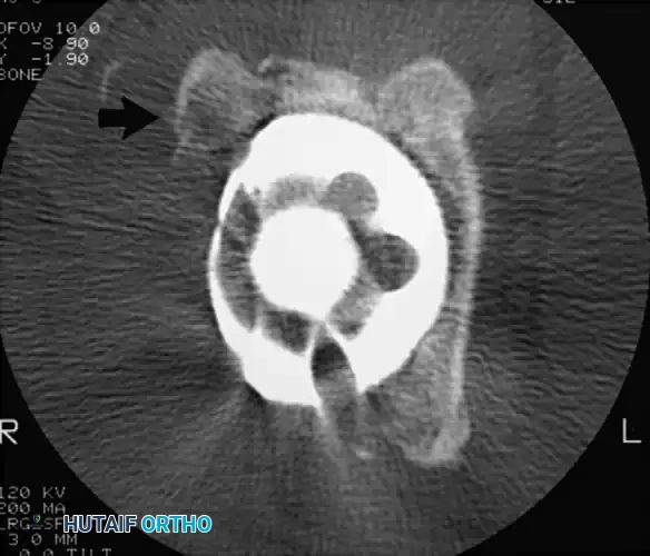 Hutaifortho's Orthopaedic Diagram