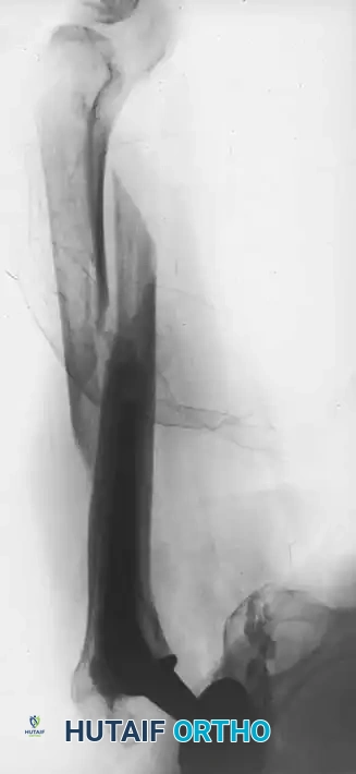 Hutaifortho's Orthopaedic Diagram