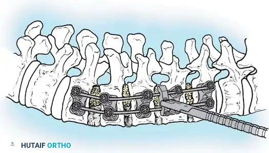 Hutaifortho's Orthopaedic Diagram