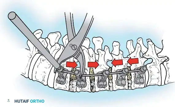 Hutaifortho's Orthopaedic Diagram