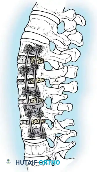 Hutaifortho's Orthopaedic Diagram