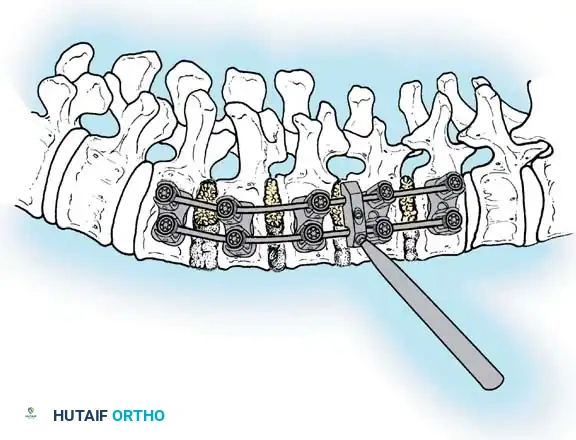 Hutaifortho's Orthopaedic Diagram