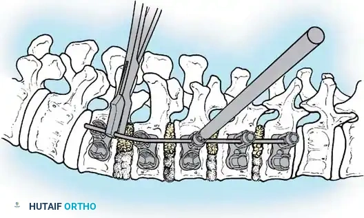 Hutaifortho's Orthopaedic Diagram