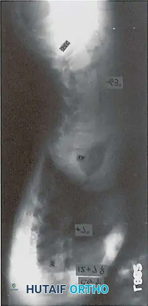 Hutaifortho's Orthopaedic Diagram