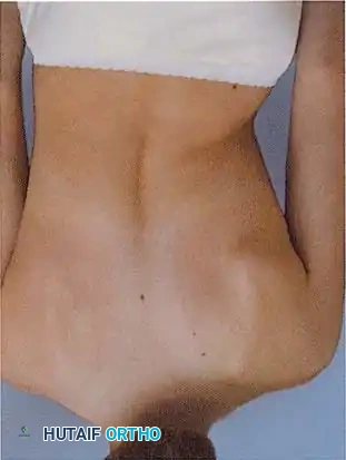 Hutaifortho's Orthopaedic Diagram