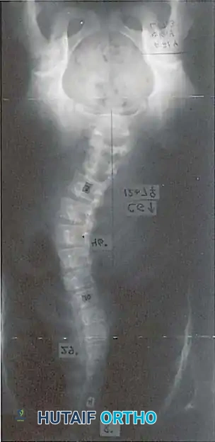 Hutaifortho's Orthopaedic Diagram