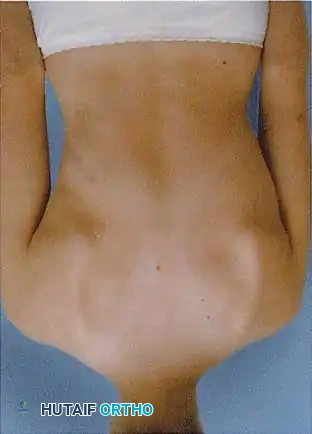 Hutaifortho's Orthopaedic Diagram