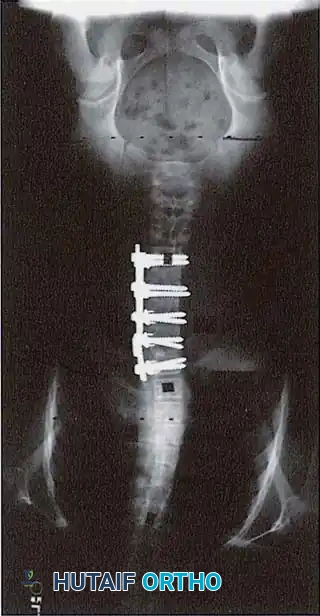 Hutaifortho's Orthopaedic Diagram