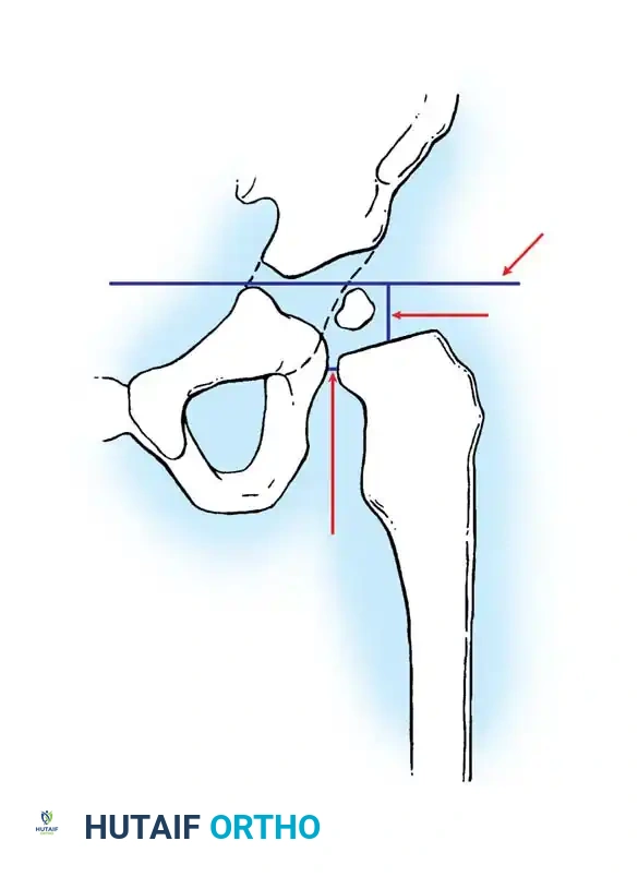 Hutaifortho's Orthopaedic Diagram