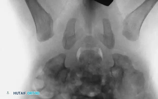 Hutaifortho's Orthopaedic Diagram