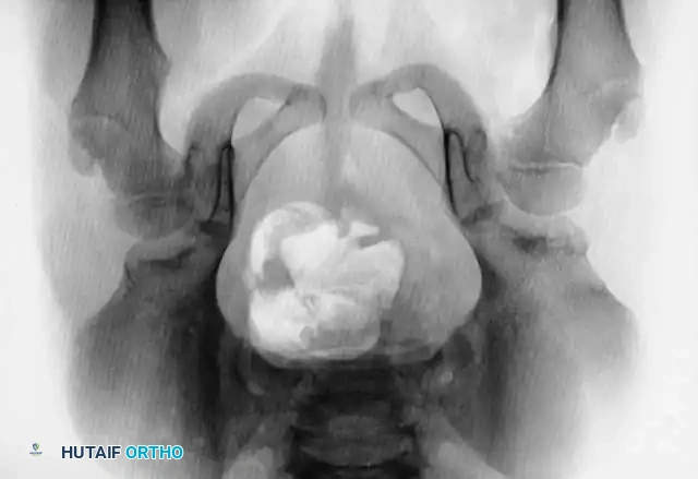 Hutaifortho's Orthopaedic Diagram