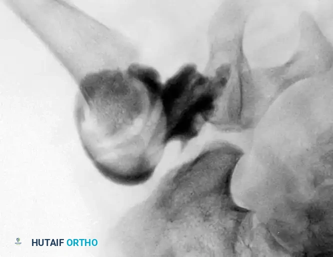 Hutaifortho's Orthopaedic Diagram