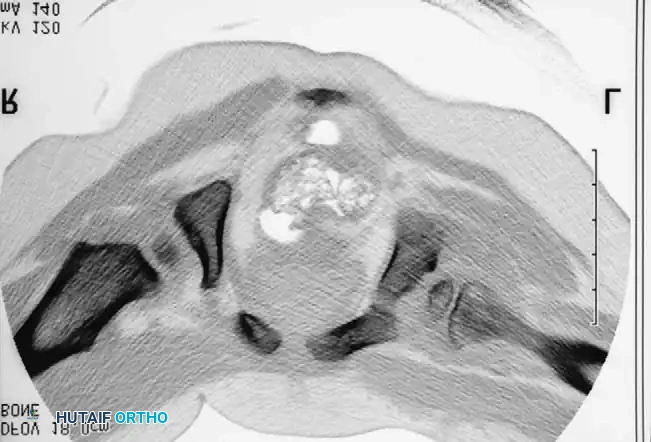 Hutaifortho's Orthopaedic Diagram