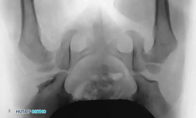 Hutaifortho's Orthopaedic Diagram