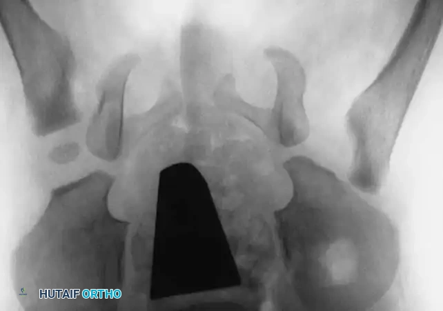 Hutaifortho's Orthopaedic Diagram