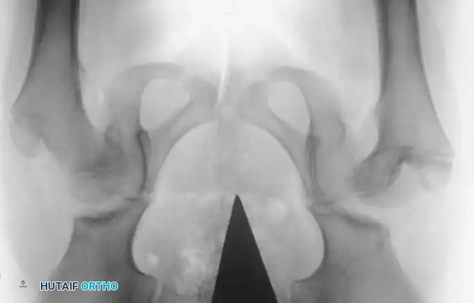 Hutaifortho's Orthopaedic Diagram