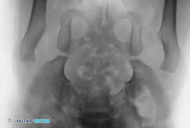 Hutaifortho's Orthopaedic Diagram