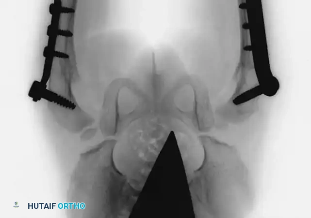 Hutaifortho's Orthopaedic Diagram