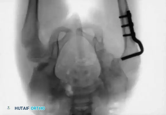 Hutaifortho's Orthopaedic Diagram