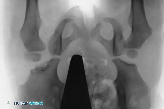 Hutaifortho's Orthopaedic Diagram