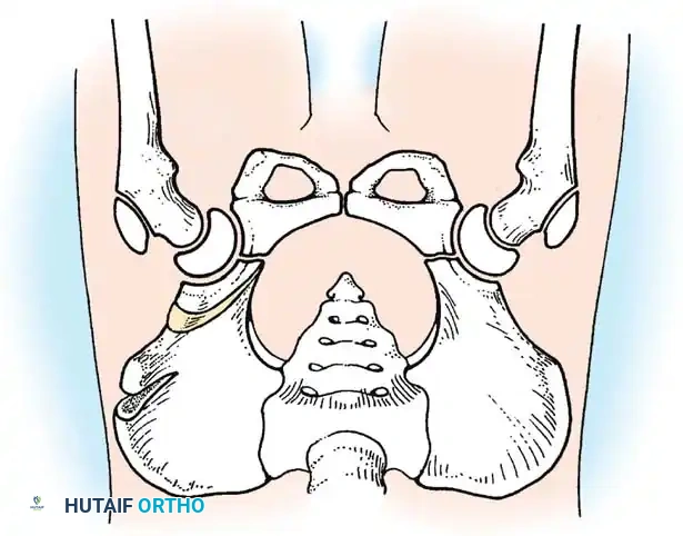 Hutaifortho's Orthopaedic Diagram