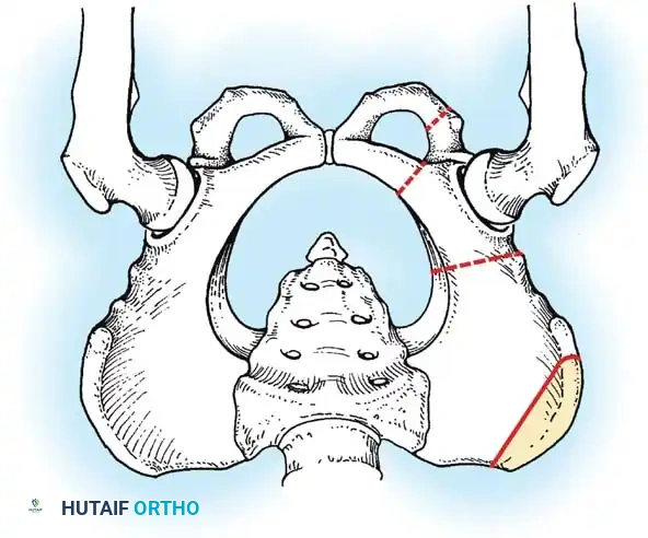 Hutaifortho's Orthopaedic Diagram