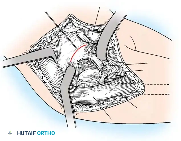 Hutaifortho's Orthopaedic Diagram