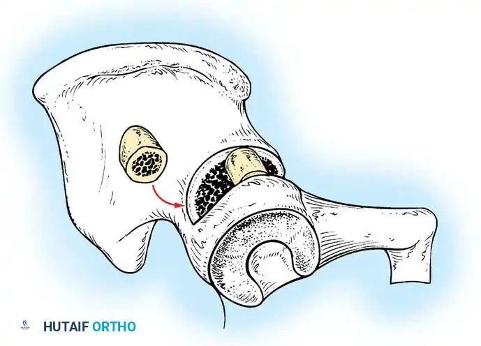 Hutaifortho's Orthopaedic Diagram