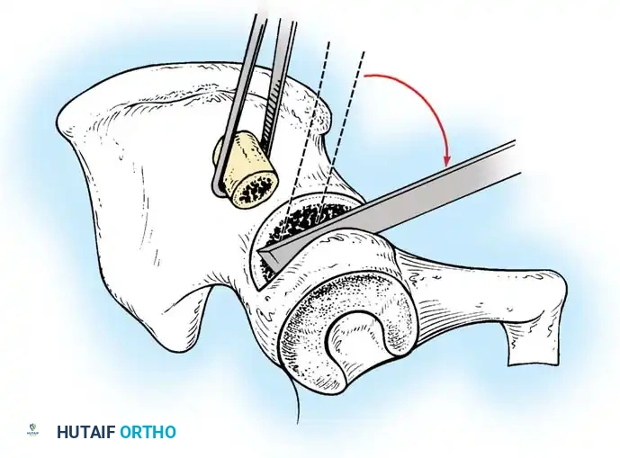 Hutaifortho's Orthopaedic Diagram