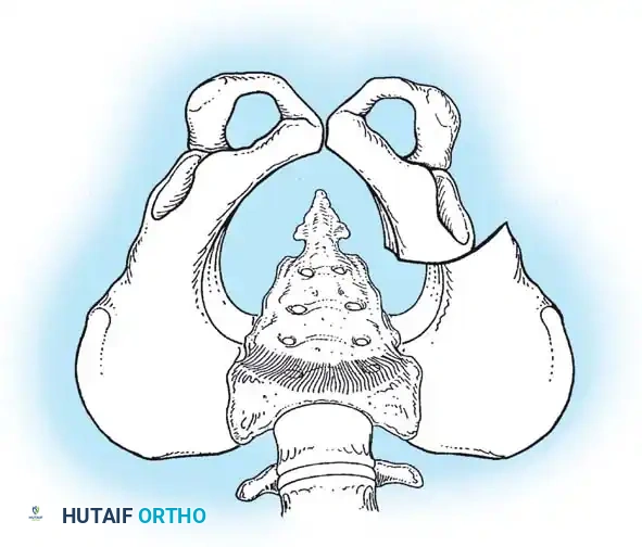 Hutaifortho's Orthopaedic Diagram