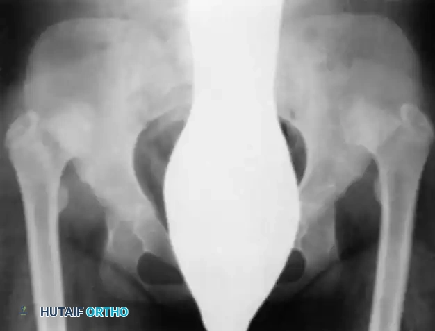 Hutaifortho's Orthopaedic Diagram
