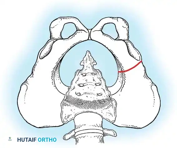 Hutaifortho's Orthopaedic Diagram